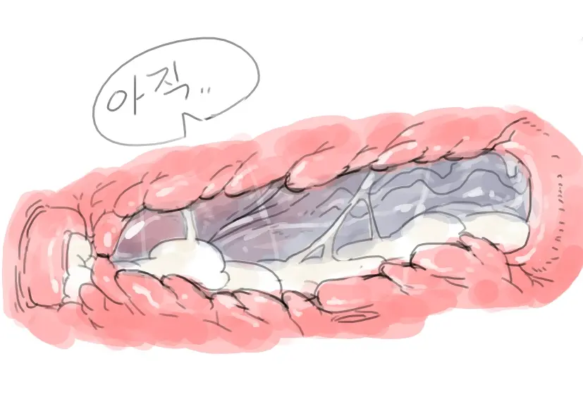 넷캔